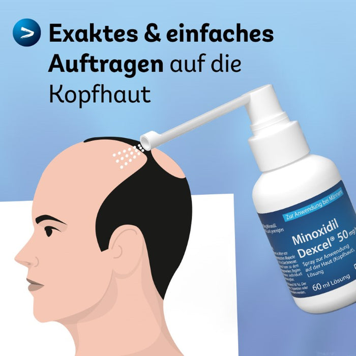 Minoxidil Dexcel 50 mg/ml Spray für Männer zur Anwendung auf der Haut (Kopfhaut), 180 ml Lösung