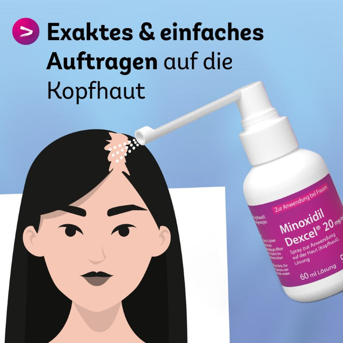 Minoxidil Dexcel 20 mg/ml Spray für Frauen zur Anwendung auf der Haut (Kopfhaut), 60 ml Lösung