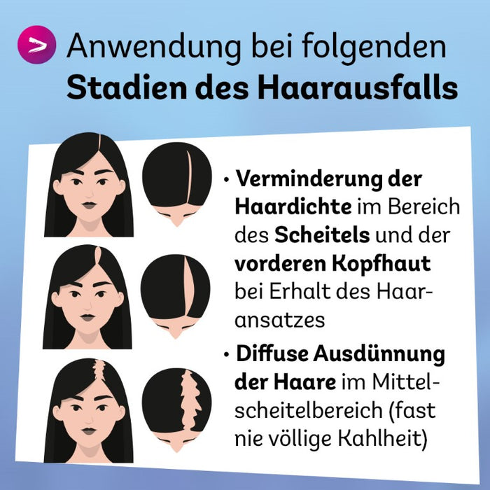 Minoxidil Dexcel 20 mg/ml Spray für Frauen zur Anwendung auf der Haut (Kopfhaut), 60 ml Lösung