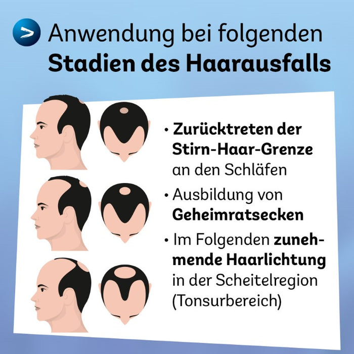 Minoxidil Dexcel 50 mg/ml Spray für Männer zur Anwendung auf der Haut (Kopfhaut), 60 ml Lösung